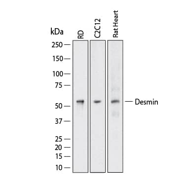 Western Blot shows lysates of RD human rhabdomyosarcoma cell line, C2C12 mouse myoblast cell line and rat heart tissue. PVDF membrane was probed with 1 µg/ml of Mouse Anti-Human Desmin Monoclonal Antibody (Catalog # MAB11607) followed by HRP-conjugated Anti-Mouse IgG Secondary Antibody (Catalog # HAF018). A specific band was detected for Desmin at approximately 52 kDa (as indicated).  This experiment was conducted under reducing conditions and using Western Blot Buffer Group 1.