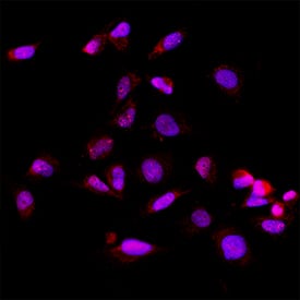 Exosome Component 9 was detected in immersion fixed U251‑MG human malignant glioblastoma cell line using Mouse Anti-Human Exosome Component 9 Monoclonal Antibody (Catalog # MAB11616) at 8 µg/ml for 3 hours at room temperature. Cells were stained using the NorthernLights™ 557-conjugated Anti-Mouse IgG Secondary Antibody (red; Catalog # NL007) and counterstained with DAPI (blue). Specific staining was localized to the nucleus. View our protocol for Fluorescent ICC Staining of Cells on Coverslips.