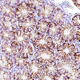 EpCAM/TROP‑1 was detected in immersion fixed paraffin-embedded sections of mouse colon using Rat Anti-Mouse EpCAM/TROP‑1 Monoclonal Antibody (Catalog # MAB11623) at 5 µg/ml overnight at 4 °C. Before incubation with the primary antibody, tissue was subjected to heat-induced epitope retrieval using VisUCyte Antigen Retrieval Reagent-Basic (Catalog # VCTS021). Tissue was stained using the HRP-conjugated Anti-Rat IgG Secondary Antibody (Catalog # HAF005) and counterstained with hematoxylin (blue). Specific staining was localized to the membrane of glandular epithelial cells. View our protocol for Chromogenic IHC Staining of Paraffin-embedded Tissue Sections.
