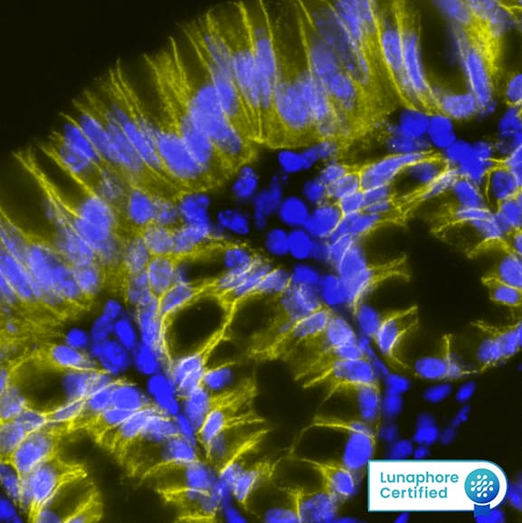 EPCAM was detected in immersion fixed paraffin-embedded sections of mouse Colon using Rat Anti-Mouse EPCAM, Monoclonal Antibody (Catalog # MAB11623) at 20ug/mL at 37 ° Celsius for 4 minutes. Before incubation with the primary antibody, tissue underwent an all-in-one dewaxing and antigen retrieval preprocessing using PreTreatment Module (PT Module) and Dewax and HIER Buffer H (pH 9; Epredia Catalog # TA-999-DHBH). Tissue was stained using the Alexa Fluor™ 647 Goat anti-Rat IgG Secondary Antibody at 1:200 at 37°Celsius for 2 minutes. (Yellow; Lunaphore Catalog # DR647RT) and counterstained with DAPI (blue; Lunaphore Catalog # DR100). Specific staining was localized to the membrane. Protocol available in COMET™ Panel Builder.
