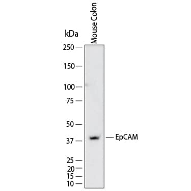 Western Blot shows lysates of mouse colon tissue. PVDF membrane was probed with 4 µg/ml of Rat Anti-Mouse EpCAM/TROP‑1 Monoclonal Antibody (Catalog # MAB11623) followed by HRP-conjugated Anti-Rat IgG Secondary Antibody (Catalog # HAF005). A specific band was detected for EpCAM/TROP‑1 at approximately 40 kDa (as indicated).  This experiment was conducted under reducing conditions and using Western Blot Buffer Group 1.