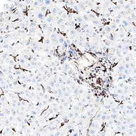 VEGFR3/Flt-4 was detected in immersion fixed paraffin-embedded sections of human liver using Rat Anti-Human VEGFR3/Flt-4 Monoclonal Antibody (Catalog # MAB11624) at 5 µg/ml overnight at 4 °C. Before incubation with the primary antibody, tissue was subjected to heat-induced epitope retrieval using VisUCyte Antigen Retrieval Reagent-Basic (Catalog # VCTS021). Tissue was stained using the HRP-conjugated Anti-Rat IgG Secondary Antibody (Catalog # HAF005) and counterstained with hematoxylin (blue). Specific staining was localized to the cell surface and cytoplasm of liver endothelial cells. View our protocol for Chromogenic IHC Staining of Paraffin-embedded Tissue Sections.