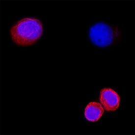 Cytokeratin 7 was detected in immersion fixed SK‑BR‑3 human breast cancer cell line using Mouse Anti-Human Cytokeratin 7 Monoclonal Antibody (Catalog # MAB11626) at 8 µg/ml for 3 hours at room temperature. Cells were stained using the NorthernLights™ 557-conjugated Anti-Mouse IgG Secondary Antibody (red; Catalog # NL007) and counterstained with DAPI (blue). Specific staining was localized to the cytoplasm. View our protocol for Fluorescent ICC Staining of Cells on Coverslips.