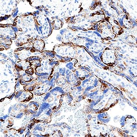 Cytokeratin 7 was detected in immersion fixed paraffin-embedded sections of human placenta using Mouse Anti-Human Cytokeratin 7 Monoclonal Antibody (Catalog # MAB11626) at 5 µg/ml for 1 hour at room temperature followed by incubation with the Anti-Mouse IgG VisUCyte™ HRP Polymer Antibody (Catalog # VC001). Before incubation with the primary antibody, tissue was subjected to heat-induced epitope retrieval using VisUCyte Antigen Retrieval Reagent-Basic (Catalog # VCTS021). Tissue was stained using DAB (brown) and counterstained with hematoxylin (blue). Specific staining was localized to the cytoplasm. View our protocol for IHC Staining with VisUCyte HRP Polymer Detection Reagents.