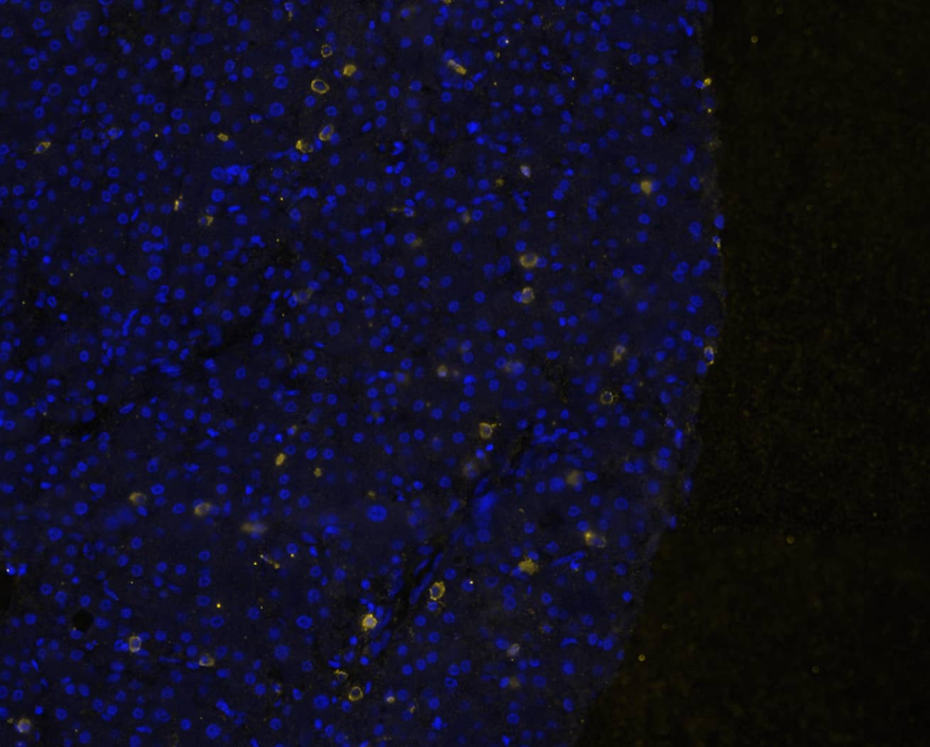 Cytokeratin 7 Peptide was detected in immersion fixed paraffin-embedded sections of human Liver Tumor using Mouse Anti-Human KRT7, Monoclonal Antibody (Catalog #MAB11626) at 25ug/mL at 37 ° Celsius for 4 minutes. Before incubation with the primary antibody, tissue underwent an all-in-one dewaxing and antigen retrieval preprocessing using PreTreatment Module (PT Module) and Dewax and HIER Buffer H (pH 9; Epredia Catalog # TA-999-DHBH). Tissue was stained using the Alexa Fluor™ 647 Goat anti-Mouse IgG Secondary Antibody at 1:200 at 37 ° Celsius for 2 minutes. (Yellow; Lunaphore Catalog # DR647MS) and counterstained with DAPI (blue; Lunaphore Catalog # DR100). Specific staining was localized to the cytoplasm. Protocol available in COMET™ Panel Builder.