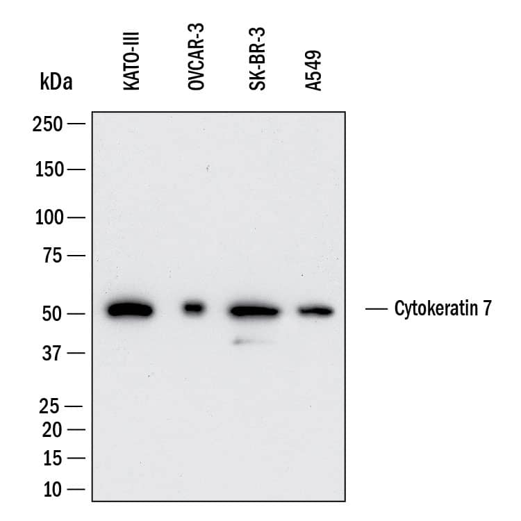 Western Blot shows lysates of KATO‑III human gastric carcinoma cell line, OVCAR‑3  human ovarian carcinoma cell line, SK‑BR‑3 human breast cancer cell line and A549 human lung carcinoma cell line. PVDF membrane was probed with 0.5 µg/ml of Mouse Anti-Human Cytokeratin 7 Monoclonal Antibody (Catalog # MAB11626) followed by HRP-conjugated Anti-Mouse IgG Secondary Antibody (Catalog # HAF018). A specific band was detected for Cytokeratin 7 at approximately 52 kDa (as indicated).  This experiment was conducted under reducing conditions and using Western Blot Buffer Group 1.