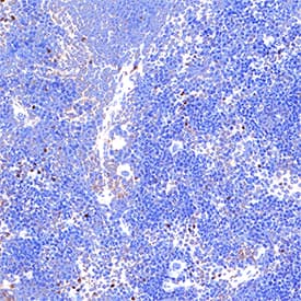 T‑bet/TBX21 was detected in immersion fixed paraffin-embedded sections of mouse spleen using Rat Anti-Mouse T‑bet/TBX21 Monoclonal Antibody (Catalog # MAB11627) at 5 µg/ml overnight at 4 °C. Before incubation with the primary antibody, tissue was subjected to heat-induced epitope retrieval using VisUCyte Antigen Retrieval Reagent-Basic (Catalog # VCTS021). Tissue was stained using the HRP-conjugated Anti-Rat IgG Secondary Antibody (Catalog # HAF005) and counterstained with hematoxylin (blue). Specific staining was localized to the nucleus. View our protocol for Chromogenic IHC Staining of Paraffin-embedded Tissue Sections.