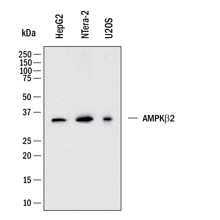 Western Blot AMPK beta 2/PRKAB2 Antibody (1092615) [Unconjugated]