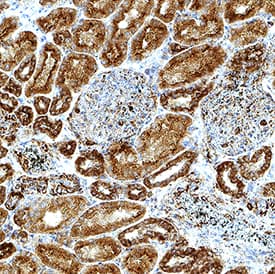 AMPK beta 1 was detected in immersion fixed paraffin-embedded sections of human kidney using Mouse Anti-Human AMPK beta 1 Monoclonal Antibody (Catalog # MAB11642) at 0.5 µg/ml for 1 hour at room temperature followed by incubation with the Anti-Mouse IgG VisUCyte™ HRP Polymer Antibody (Catalog # VC001). Before incubation with the primary antibody, tissue was subjected to heat-induced epitope retrieval using VisUCyte Antigen Retrieval Reagent-Basic (Catalog # VCTS021). Tissue was stained using DAB (brown) and counterstained with hematoxylin (blue). Specific staining was localized to the cytoplasm. View our protocol for IHC Staining with VisUCyte HRP Polymer Detection Reagents.