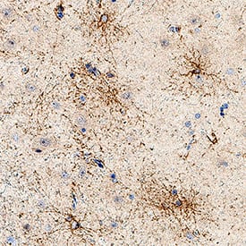 Aquaporin 4/AQP4 was detected in immersion fixed paraffin-embedded sections of human brain cortex using Mouse Anti-Human Aquaporin 4/AQP4 Monoclonal Antibody (Catalog # MAB11659) at 5 µg/ml for 1 hour at room temperature followed by incubation with the Anti-Mouse IgG VisUCyte™ HRP Polymer Antibody (Catalog # VC001) or the HRP-conjugated Anti-Mouse IgG Secondary Antibody (Catalog # HAF007). Before incubation with the primary antibody, tissue was subjected to heat-induced epitope retrieval using VisUCyte Antigen Retrieval Reagent-Basic (Catalog # VCTS021). Tissue was stained using DAB (brown) and counterstained with hematoxylin (blue). Specific staining was localized to the cell surface of astrocytes. View our protocol for IHC Staining with VisUCyte HRP Polymer Detection Reagents.