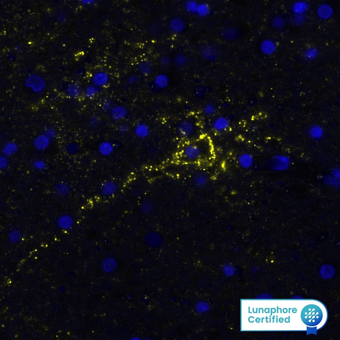 AQP4 was detected in immersion fixed paraffin-embedded sections of human brain Cortex using Mouse Anti-Human AQP4, Monoclonal Antibody (Catalog #MAB11659) at 25ug/mL at 37 ° Celsius for 8 minutes. Before incubation with the primary antibody, tissue underwent an all-in-one dewaxing and antigen retrieval preprocessing using PreTreatment Module (PT Module) and Dewax and HIER Buffer H (pH 9; Epredia Catalog # TA-999-DHBH). Tissue was stained using the Alexa Fluor™ 647 Goat anti-Mouse IgG Secondary Antibody at 1:200 at 37 ° Celsius for 8 minutes. (Yellow; Lunaphore Catalog # DR647MS) and counterstained with DAPI (blue; Lunaphore Catalog # DR100). Specific staining was localized to the brain astrocytes. Protocol available in COMET™ Panel Builder.