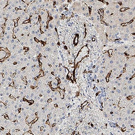 CD31/PECAM‑1 was detected in immersion fixed paraffin-embedded sections of human liver using Mouse Anti-Human CD31/PECAM‑1 Monoclonal Antibody (Catalog # MAB11666) at 0.05 µg/ml for 1 hour at room temperature followed by incubation with the Anti-Mouse IgG VisUCyte™ HRP Polymer Antibody (Catalog # VC001) or the HRP-conjugated Anti-Mouse IgG Secondary Antibody (Catalog # HAF007). Before incubation with the primary antibody, tissue was subjected to heat-induced epitope retrieval using VisUCyte Antigen Retrieval Reagent-Basic (Catalog # VCTS021). Tissue was stained using DAB (brown) and counterstained with hematoxylin (blue). Specific staining was localized to the cell surface. View our protocol for IHC Staining with VisUCyte HRP Polymer Detection Reagents.