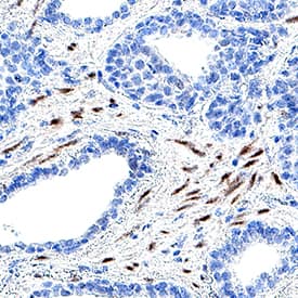 RBPMS was detected in immersion fixed paraffin-embedded sections of human testis using Mouse Anti-Human RBPMS Monoclonal Antibody (Catalog # MAB11670) at 5 µg/ml for 1 hour at room temperature followed by incubation with the Anti-Mouse IgG VisUCyte™ HRP Polymer Antibody (Catalog # VC001) or the HRP-conjugated Anti-Mouse IgG Secondary Antibody (Catalog # HAF007). Before incubation with the primary antibody, tissue was subjected to heat-induced epitope retrieval using VisUCyte Antigen Retrieval Reagent-Basic (Catalog # VCTS021). Tissue was stained using DAB (brown) and counterstained with hematoxylin (blue). Specific staining was localized to the nucleus and cytoplasm of smooth muscle. View our protocol for IHC Staining with VisUCyte HRP Polymer Detection Reagents.
