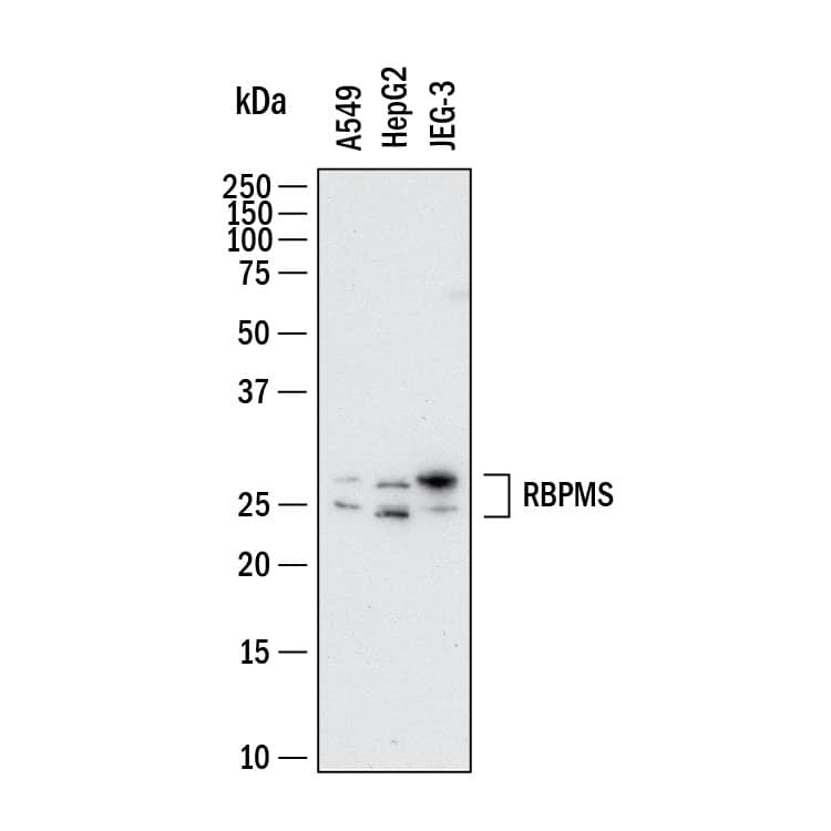 Western Blot shows lysates of A549 human lung carcinoma cell line, HepG2 human hepatocellular carcinoma cell line and JEG‑3 human epithelial choriocarcinoma cell line. PVDF membrane was probed with 2 µg/ml of Mouse Anti-Human RBPMS Monoclonal Antibody (Catalog # MAB11670) followed by HRP-conjugated Anti-Mouse IgG Secondary Antibody (Catalog # HAF018). Specific bands were detected for RBPMS at approximately 28, 32 kDa (as indicated).  This experiment was conducted under reducing conditions and using Western Blot Buffer Group 1.