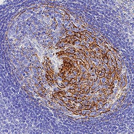 VCAM‑1/CD106 was detected in immersion fixed paraffin-embedded sections of human tonsil using Mouse Anti-Human VCAM‑1/CD106 Monoclonal Antibody (Catalog # MAB11671) at 5 µg/ml for 1 hour at room temperature followed by incubation with the Anti-Mouse IgG VisUCyte™ HRP Polymer Antibody (Catalog # VC001) or the HRP-conjugated Anti-Mouse IgG Secondary Antibody (Catalog # HAF007). Before incubation with the primary antibody, tissue was subjected to heat-induced epitope retrieval using VisUCyte Antigen Retrieval Reagent-Basic (Catalog # VCTS021). Tissue was stained using DAB (brown) and counterstained with hematoxylin (blue). Specific staining was localized to the cell membrane. View our protocol for IHC Staining with VisUCyte HRP Polymer Detection Reagents.