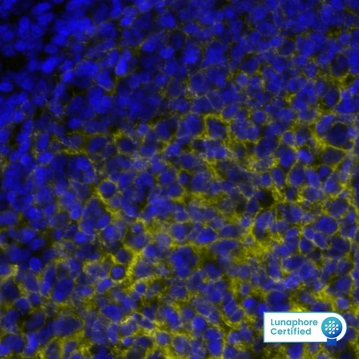 VCAM1 was detected in immersion fixed paraffin-embedded sections of human Tonsil using Mouse Anti-Human VCAM1, Monoclonal Antibody (Catalog #MAB11671) at 15ug/mL at 37 ° Celsius for 4 minutes. Before incubation with the primary antibody, tissue underwent an all-in-one dewaxing and antigen retrieval preprocessing using PreTreatment Module (PT Module) and Dewax and HIER Buffer H (pH 9; Epredia Catalog # TA-999-DHBH).Tissue was stained using the Alexa Fluor™ 647 Goat anti-Mouse IgG Secondary Antibody at 1:200 at 37 ° Celsius for 2 minutes. (Yellow; Lunaphore Catalog # DR647MS) and counterstained with DAPI (blue; Lunaphore Catalog # DR100). Specific staining was localized to the membrane. Protocol available in COMET™ Panel Builder.