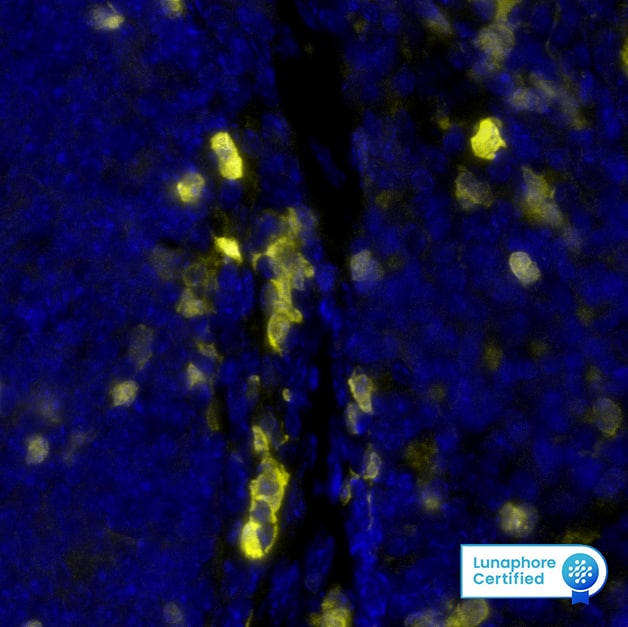 S100A4 was detected in immersion fixed paraffin-embedded sections of mouse Spleen using Rat Anti-Mouse S100A4, Monoclonal Antibody (Catalog #MAB11673) at 0.5ug/mL at 32° Celsius for 4 minutes. Before incubation with the primary antibody, tissue underwent an all-in-one dewaxing and antigen retrieval preprocessing using PreTreatment Module (PT Module) and Dewax and HIER Buffer H (pH 9; Epredia Catalog # TA-999-DHBH). Tissue was stained using the Alexa Fluor™ 555 Goat anti-Rat IgG Secondary Antibody at 1:100 at 37 ° Celsius for 2 minutes. (Yellow; Lunaphore Catalog # DR555RT) and counterstained with DAPI (blue; Lunaphore Catalog # DR100). Specific staining was localized to the cytoplasm and nucleus. Protocol available in COMET™ Panel Builder.