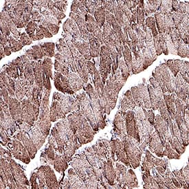  beta ‑Actin was detected in perfusion fixed paraffin-embedded sections of mouse heart using Rat Anti-Mouse  beta ‑Actin Monoclonal Antibody (Catalog # MAB11702) at 0.05 µg/ml overnight at 4 °C. Tissue was stained using the HRP-conjugated Anti-Rat IgG Secondary Antibody (Catalog # HAF005) and counterstained with hematoxylin (blue). Specific staining was localized to the cytoplasm. View our protocol for Chromogenic IHC Staining of Paraffin-embedded Tissue Sections.