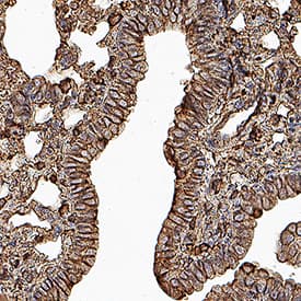  beta ‑Actin was detected in perfusion fixed paraffin-embedded sections of mouse lung using Rat Anti-Mouse  beta ‑Actin Monoclonal Antibody (Catalog # MAB11702) at 0.05 µg/ml overnight at 4 °C. Tissue was stained using the HRP-conjugated Anti-Rat IgG Secondary Antibody (Catalog # HAF005) and counterstained with hematoxylin (blue). Specific staining was localized to the cytoplasm. View our protocol for Chromogenic IHC Staining of Paraffin-embedded Tissue Sections.