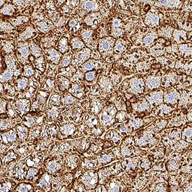  beta ‑Actin was detected in perfusion fixed paraffin-embedded sections of mouse liver using Rat Anti-Mouse  beta ‑Actin Monoclonal Antibody (Catalog # MAB11702) at 0.05 µg/ml overnight at 4 °C. Tissue was stained using the HRP-conjugated Anti-Rat IgG Secondary Antibody (Catalog # HAF005) and counterstained with hematoxylin (blue). Specific staining was localized to the cytoplasm. View our protocol for Chromogenic IHC Staining of Paraffin-embedded Tissue Sections.