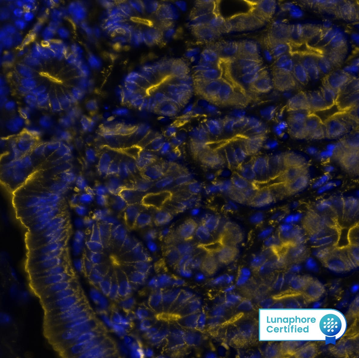  beta -Actin was detected in perfusion fixed paraffin-embedded sections of mouse Stomach using Rat Anti-Mouse  beta -Actin, Monoclonal Antibody (Catalog #MAB11702) at 0.25ug/mL at 37° Celsius for 2 minutes.Before incubation with the primary antibody, tissue underwent an all-in-one dewaxing and antigen retrieval preprocessing using PreTreatment Module (PT Module) and Dewax and HIER Buffer H (pH 9; Epredia Catalog #TA-999-DHBH). Tissue was stained using the Alexa Fluor™ 555 Goat anti-Rat IgG Secondary Antibody at 1:100 at 37 ° Celsius for 2 minutes. (Yellow; Lunaphore Catalog # DR555RT) and counterstained with DAPI (blue; Lunaphore Catalog # DR100). Specific staining was localized to the cell membrane. Protocol available in COMET™ Panel Builder.​