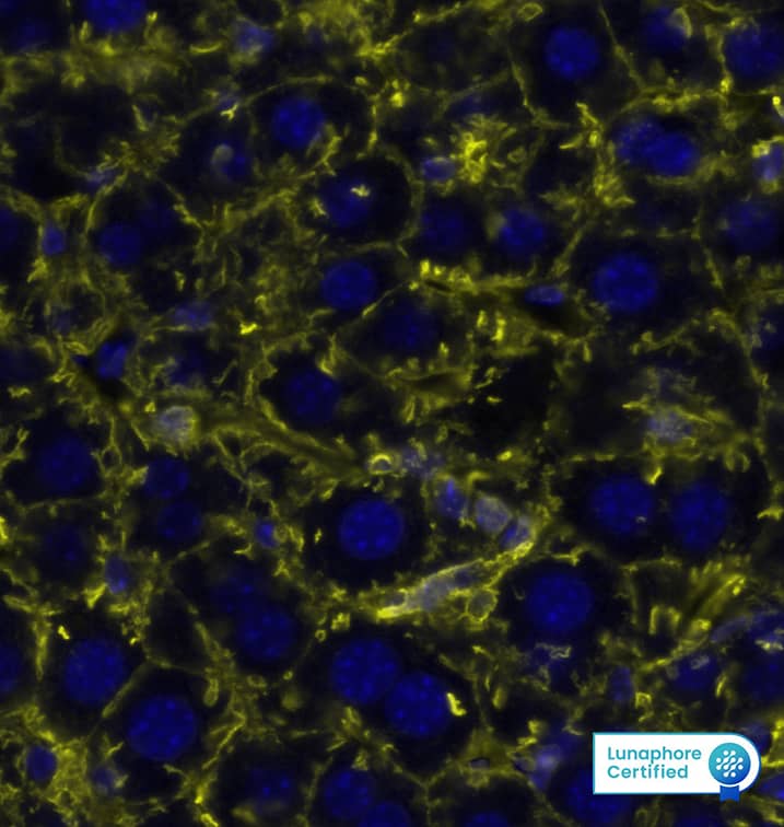  beta -Actin was detected in immersion fixed paraffin-embedded sections of mouse liver using Rat Anti-Mouse  beta -Actin, Monoclonal Antibody (Catalog # MAB11702) at 0.25ug/mL at 37° Celsius for 2 minutes. Before incubation with the primary antibody, tissue underwent an all-in-one dewaxing and antigen retrieval preprocessing using PreTreatment Module (PT Module) and Dewax and HIER Buffer H (pH 9; Epredia Catalog # TA-999-DHBH). Tissue was stained using the Alexa Fluor™ 555 Goat anti-Rat IgG Secondary Antibody at 1:100 at 37 ° Celsius for 2 minutes. (Yellow; Lunaphore Catalog # DR555RT) and counterstained with DAPI (blue; Lunaphore Catalog # DR100). Specific staining was localized to the cytoplasm. Protocol available in COMET™ Panel Builder.