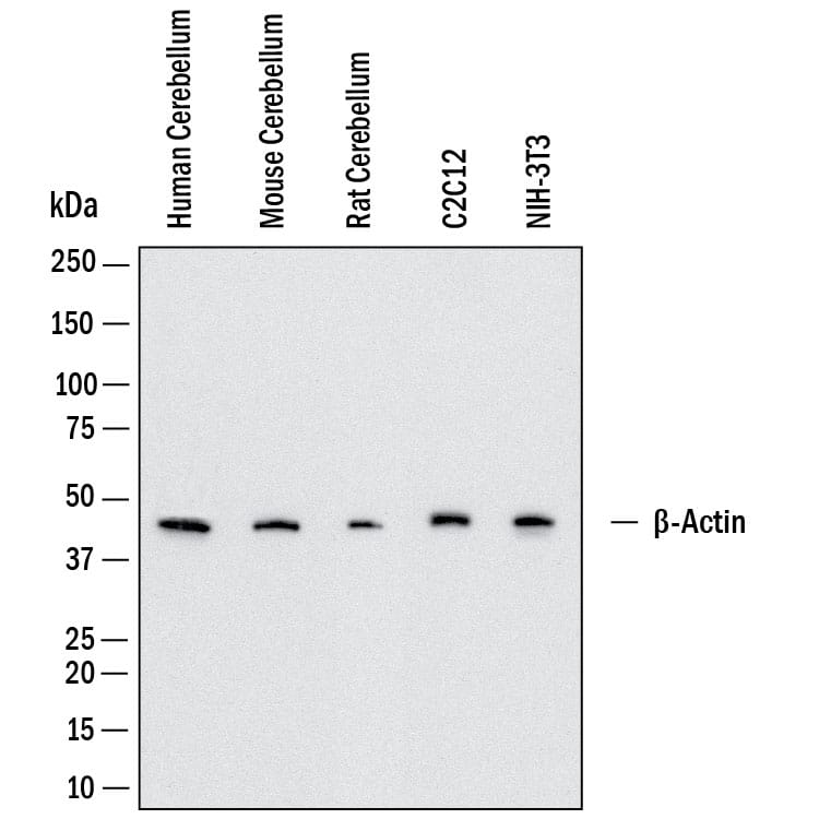 Western Blot shows lysates of human cerebellum, mouse cerebellum, rat cerebellum, C2C12 mouse myoblast cell line and NIH‑3T3 mouse embryonic fibroblast cell line. PVDF membrane was probed with 0.5 µg/ml of Rat Anti-Mouse  beta ‑Actin Monoclonal Antibody (Catalog # MAB11702) followed by HRP-conjugated Anti-Rat IgG Secondary Antibody (Catalog # HAF005). A specific band was detected for  beta ‑Actin at approximately 45 kDa (as indicated).  This experiment was conducted under reducing conditions and using Western Blot Buffer Group 1.