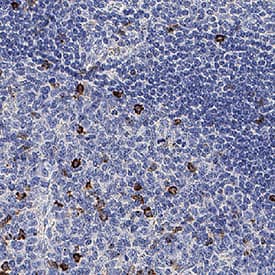 CD57 was detected in immersion fixed paraffin-embedded sections of human lymph node using Mouse Anti-Human CD57 Monoclonal Antibody (Catalog # MAB11708) at 1 µg/ml for 1 hour at room temperature followed by incubation with the Anti-Mouse IgG VisUCyte™ HRP Polymer Antibody (Catalog # VC001) or the HRP-conjugated Anti-Mouse IgG Secondary Antibody (Catalog # HAF007). Before incubation with the primary antibody, tissue was subjected to heat-induced epitope retrieval using VisUCyte Antigen Retrieval Reagent-Basic (Catalog # VCTS021). Tissue was stained using DAB (brown) and counterstained with hematoxylin (blue). Specific staining was localized to the cell surface. View our protocol for IHC Staining with VisUCyte HRP Polymer Detection Reagents.