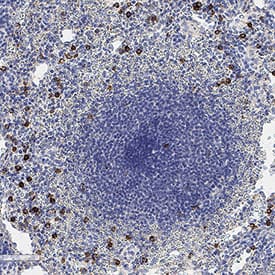 CD57 was detected in immersion fixed paraffin-embedded sections of human spleen using Mouse Anti-Human CD57 Monoclonal Antibody (Catalog # MAB11708) at 1 µg/ml for 1 hour at room temperature followed by incubation with the Anti-Mouse IgG VisUCyte™ HRP Polymer Antibody (Catalog # VC001) or the HRP-conjugated Anti-Mouse IgG Secondary Antibody (Catalog # HAF007). Before incubation with the primary antibody, tissue was subjected to heat-induced epitope retrieval using VisUCyte Antigen Retrieval Reagent-Basic (Catalog # VCTS021). Tissue was stained using DAB (brown) and counterstained with hematoxylin (blue). Specific staining was localized to the cell surface. View our protocol for IHC Staining with VisUCyte HRP Polymer Detection Reagents.