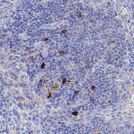 CD57 was detected in immersion fixed paraffin-embedded sections of human tonsil using Mouse Anti-Human CD57 Monoclonal Antibody (Catalog # MAB11708) at 1 µg/ml for 1 hour at room temperature followed by incubation with the Anti-Mouse IgG VisUCyte™ HRP Polymer Antibody (Catalog # VC001) or the HRP-conjugated Anti-Mouse IgG Secondary Antibody (Catalog # HAF007). Before incubation with the primary antibody, tissue was subjected to heat-induced epitope retrieval using VisUCyte Antigen Retrieval Reagent-Basic (Catalog # VCTS021). Tissue was stained using DAB (brown) and counterstained with hematoxylin (blue). Specific staining was localized to the cell surface. View our protocol for IHC Staining with VisUCyte HRP Polymer Detection Reagents.