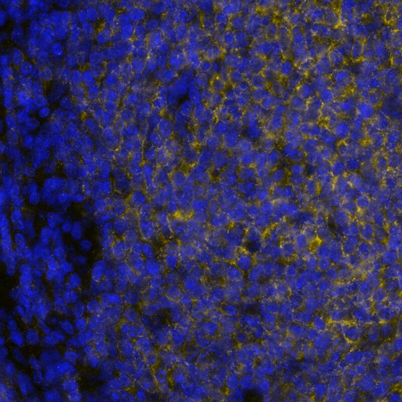 CD19 was detected in immersion fixed paraffin-embedded sections of Hodgkin Lymphoma using Mouse Anti-Human CD19 Monoclonal Antibody (Catalog# MAB11717) at 1 µg/mL at 37° Celsius for 4 minutes. Before incubation with the primary antibody, tissue underwent an all-in-one dewaxing and antigen retrieval preprocessing using PreTreatment Module (PT Module) and Dewax and HIER Buffer H (pH 9; Epredia Catalog # TA-999-DHBH). Tissue was stained using the Alexa Fluor™ 647 Goat anti-Mouse IgG Secondary Antibody at 1:200 at 37 ° Celsius for 2 minutes. (Yellow; Lunaphore Catalog # DR647MS) and counterstained with DAPI (blue; Lunaphore Catalog # DR100). Specific staining was localized to the membrane. Protocol available in COMET™ Panel Builder.