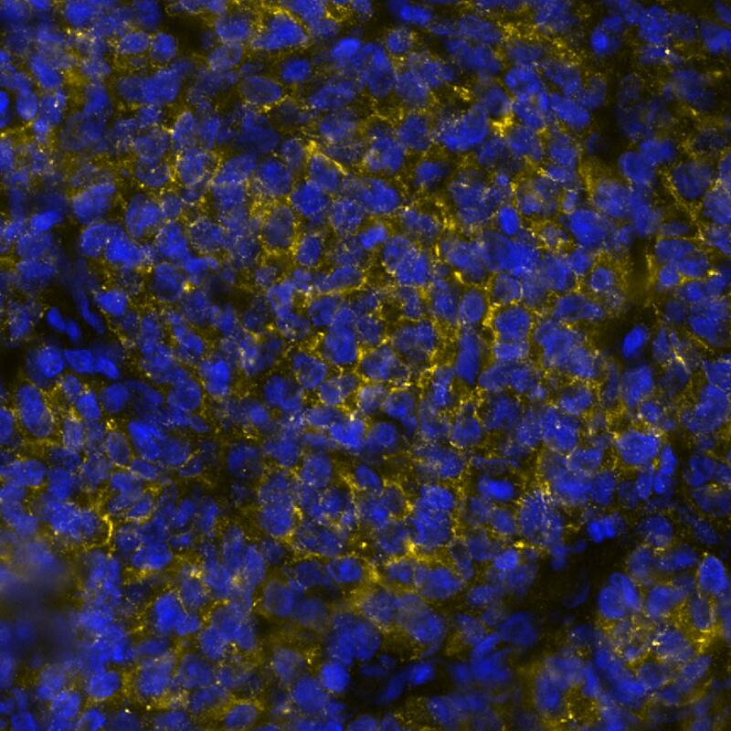 CD19 was detected in immersion fixed paraffin-embedded sections of B-Cell Lymphoma using Mouse Anti-Human CD19 Monoclonal Antibody (Catalog # MAB11717) at 1 µg/mL at 37 ° Celsius for 4 minutes. Before incubation with the primary antibody, tissue underwent an all-in-one dewaxing and antigen retrieval preprocessing using PreTreatment Module (PT Module) and Dewax and HIER Buffer H (pH 9; Epredia Catalog # TA-999-DHBH). Tissue was stained using the Alexa Fluor™ 647 Goat anti-Mouse IgG Secondary Antibody at 1:200 at 37 ° Celsius for 2 minutes. (Yellow; Lunaphore Catalog # DR647MS) and counterstained with DAPI (blue; Lunaphore Catalog # DR100). Specific staining was localized to the membrane. Protocol available in COMET™ Panel Builder.