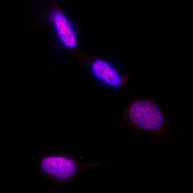 MCM4 was detected in immersion fixed A549 human lung carcinoma cell line using Mouse Anti-Human MCM4 Monoclonal Antibody (Catalog # MAB11718) at 8 µg/ml for 3 hours at room temperature. Cells were stained using the NorthernLights&trade; 557-conjugated Anti-Mouse IgG Secondary Antibody (red; Catalog # NL007) and counterstained with DAPI (blue). Specific staining was localized to the nucleus. View our protocol for Fluorescent ICC Staining of Cells on Coverslips.