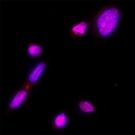 MCM4 was detected in immersion fixed MDA‑MB‑231 human breast cancer cell line using Mouse Anti-Human MCM4 Monoclonal Antibody (Catalog # MAB11718) at 8 µg/ml for 3 hours at room temperature. Cells were stained using the NorthernLights&trade; 557-conjugated Anti-Mouse IgG Secondary Antibody (red; Catalog # NL007) and counterstained with DAPI (blue). Specific staining was localized to the nucleus. View our protocol for Fluorescent ICC Staining of Cells on Coverslips.