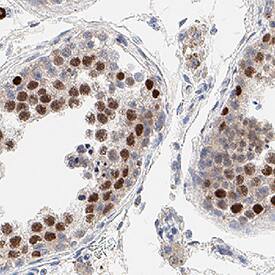 MCM4 was detected in immersion fixed paraffin-embedded sections of human testis using Mouse Anti-Human MCM4 Monoclonal Antibody (Catalog # MAB11718) at 5 µg/ml for 1 hour at room temperature followed by incubation with the Anti-Mouse IgG VisUCyte&trade; HRP Polymer Antibody (Catalog # VC001) or the HRP-conjugated Anti-Mouse IgG Secondary Antibody (Catalog # HAF007). Before incubation with the primary antibody, tissue was subjected to heat-induced epitope retrieval using VisUCyte Antigen Retrieval Reagent-Basic (Catalog # VCTS021). Tissue was stained using DAB (brown) and counterstained with hematoxylin (blue). Specific staining was localized to the nucleus. View our protocol for Chromogenic IHC Staining of Paraffin-embedded Tissue Sections.