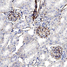CD31/PECAM‑1 was detected in perfusion fixed paraffin-embedded sections of mouse kidney using Rabbit Anti-Mouse CD31/PECAM‑1 Monoclonal Antibody (Catalog # MAB11720) at 5 µg/ml for 1 hour at room temperature followed by incubation with the Anti-Rabbit IgG VisUCyte&trade; HRP Polymer Antibody (Catalog # VC003) or the HRP-conjugated Anti-Rabbit IgG Secondary Antibody (Catalog # HAF008). Before incubation with the primary antibody, tissue was subjected to heat-induced epitope retrieval using VisUCyte Antigen Retrieval Reagent-Basic (Catalog # VCTS021). Tissue was stained using DAB (brown) and counterstained with hematoxylin (blue). Specific staining was localized to the membrane of endothelial cells. View our protocol for IHC Staining with VisUCyte HRP Polymer Detection Reagents.