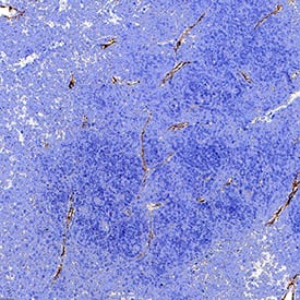 CD31/PECAM‑1 was detected in perfusion fixed paraffin-embedded sections of mouse thymus using Rabbit Anti-Mouse CD31/PECAM‑1 Monoclonal Antibody (Catalog # MAB11720) at 5 µg/ml for 1 hour at room temperature followed by incubation with the Anti-Rabbit IgG VisUCyte&trade; HRP Polymer Antibody (Catalog # VC003) or the HRP-conjugated Anti-Rabbit IgG Secondary Antibody (Catalog # HAF008). Before incubation with the primary antibody, tissue was subjected to heat-induced epitope retrieval using VisUCyte Antigen Retrieval Reagent-Basic (Catalog # VCTS021). Tissue was stained using DAB (brown) and counterstained with hematoxylin (blue). Specific staining was localized to the membrane of endothelial cells. View our protocol for IHC Staining with VisUCyte HRP Polymer Detection Reagents.