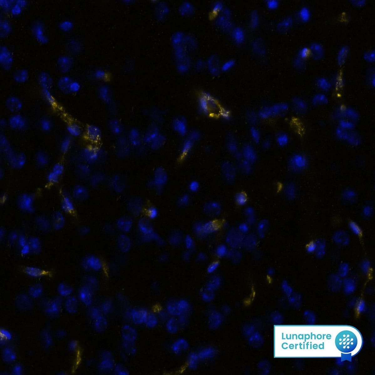 CD31 was detected in perfusion fixed-frozen sections of mouse Brain Cortex using Rabbit Anti-Mouse CD31, Monoclonal Antibody (Catalog #MAB11720) at 10ug/mL at 27° Celsius for 4 minutes. Before incubation with the primary antibody, tissue underwent preprocessing by incubating tissue with Multi Staining Buffer (Lunaphore Catalog # BU06) for 5minutes at room temperature followed by a 20 minute incubation in Tris-Buffered Saline + 0.2% Triton at room temperature. Tissue was stained using the Alexa Fluor™ Plus 647 Goat anti-Rabbit IgG Secondary Antibody at 1:200 at 37 ° Celsius for 2 minutes. (Yellow; Lunaphore Catalog # DR647RB) and counterstained with DAPI (blue; Lunaphore Catalog # DR100). Specific staining was localized to the cytoplasm of endothelial cells. Protocol available in COMET™ Panel Builder.
