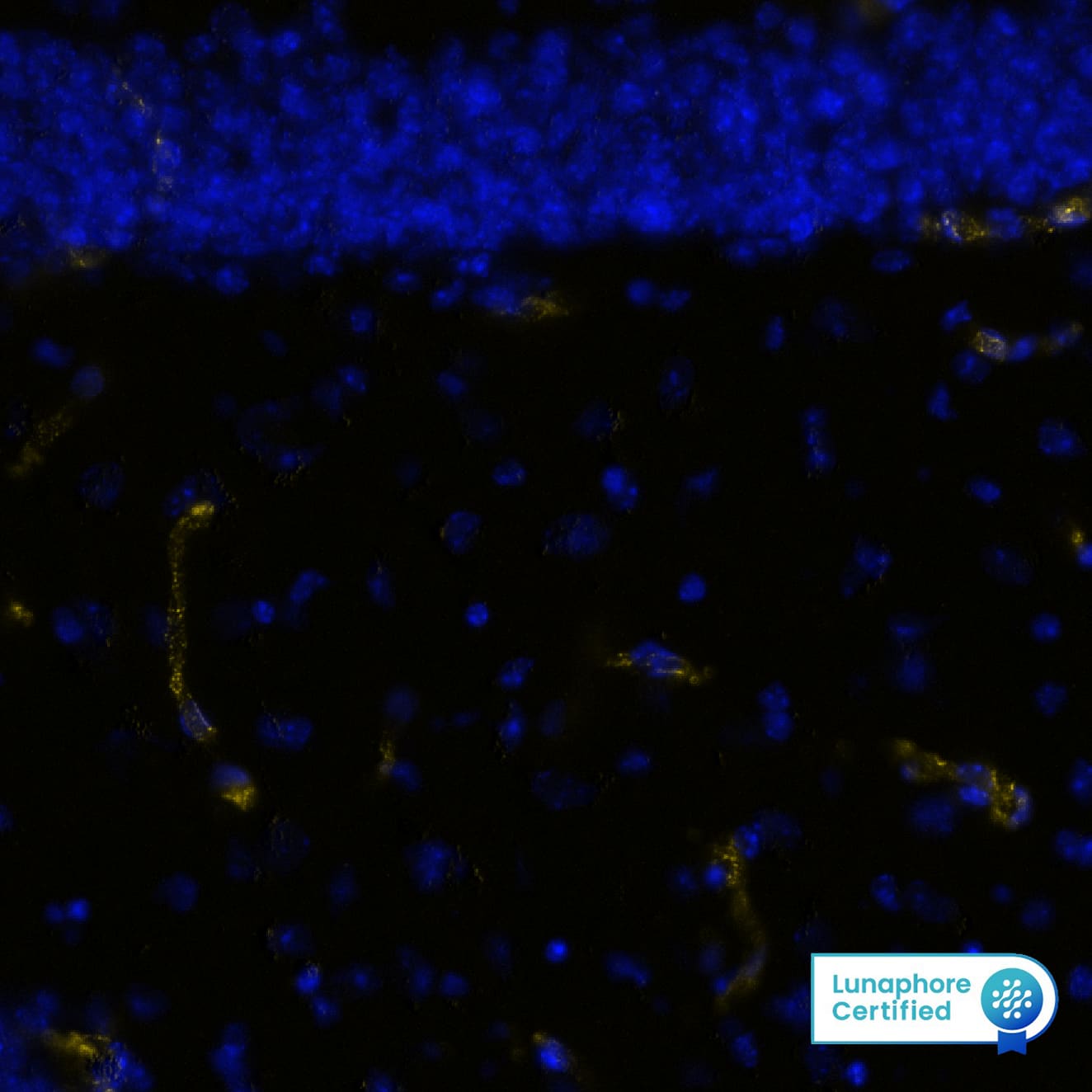 CD31 was detected in perfusion fixed-frozen sections of mouse Hippocampus using Rabbit Anti-Mouse CD31, Monoclonal Antibody (Catalog #MAB11720) at 10ug/mL at 27° Celsius for 4 minutes. Before incubation with the primary antibody, tissue underwent preprocessing by incubating tissue with Multi Staining Buffer (Lunaphore Catalog # BU06) for 5minutes at room temperature followed by a 20 minute incubation in Tris-Buffered Saline + 0.2% Triton at room temperature. Tissue was stained using the Alexa Fluor™ Plus 647 Goat anti-Rabbit IgG Secondary Antibody at 1:200 at 37 ° Celsius for 2 minutes. (Yellow; Lunaphore Catalog # DR647RB) and counterstained with DAPI (blue; Lunaphore Catalog # DR100). Specific staining was localized to the cytoplasm of endothelial cells. Protocol available in COMET™ Panel Builder.