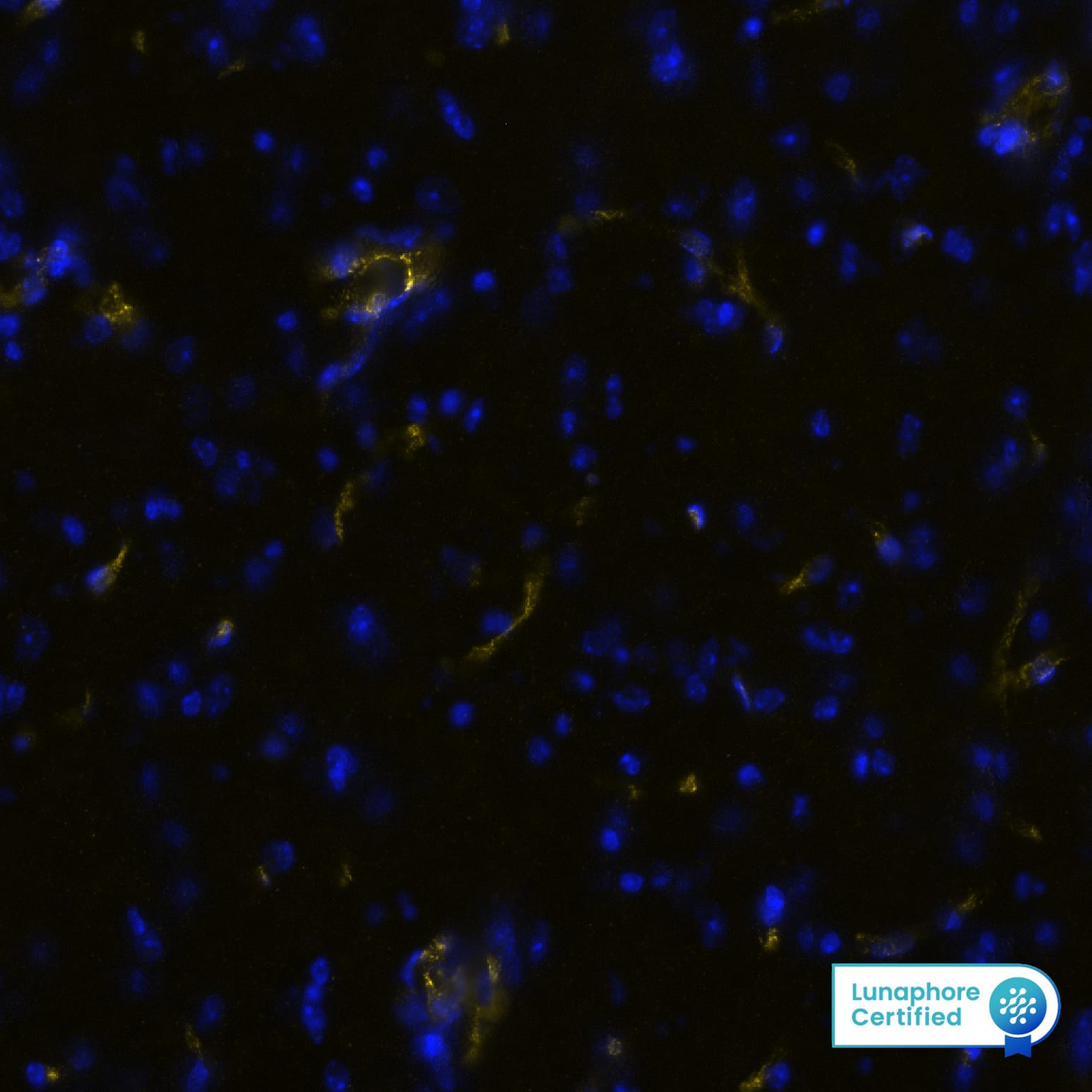 CD31 was detected in perfusion fixed-frozen sections of mouse Brain Medulla using Rabbit Anti-Mouse CD31, Monoclonal Antibody (Catalog #MAB11720) at 10ug/mL at 27° Celsius for 4 minutes. Before incubation with the primary antibody, tissue underwent preprocessing by incubating tissue with Multi Staining Buffer (Lunaphore Catalog # BU06) for 5minutes at room temperature followed by a 20 minute incubation in Tris-Buffered Saline + 0.2% Triton at room temperature. Tissue was stained using the Alexa Fluor™ Plus 647 Goat anti-Rabbit IgG Secondary Antibody at 1:200 at 37 ° Celsius for 2 minutes. (Yellow; Lunaphore Catalog # DR647RB) and counterstained with DAPI (blue; Lunaphore Catalog # DR100). Specific staining was localized to the cytoplasm of endothelial cells. Protocol available in COMET™ Panel Builder.