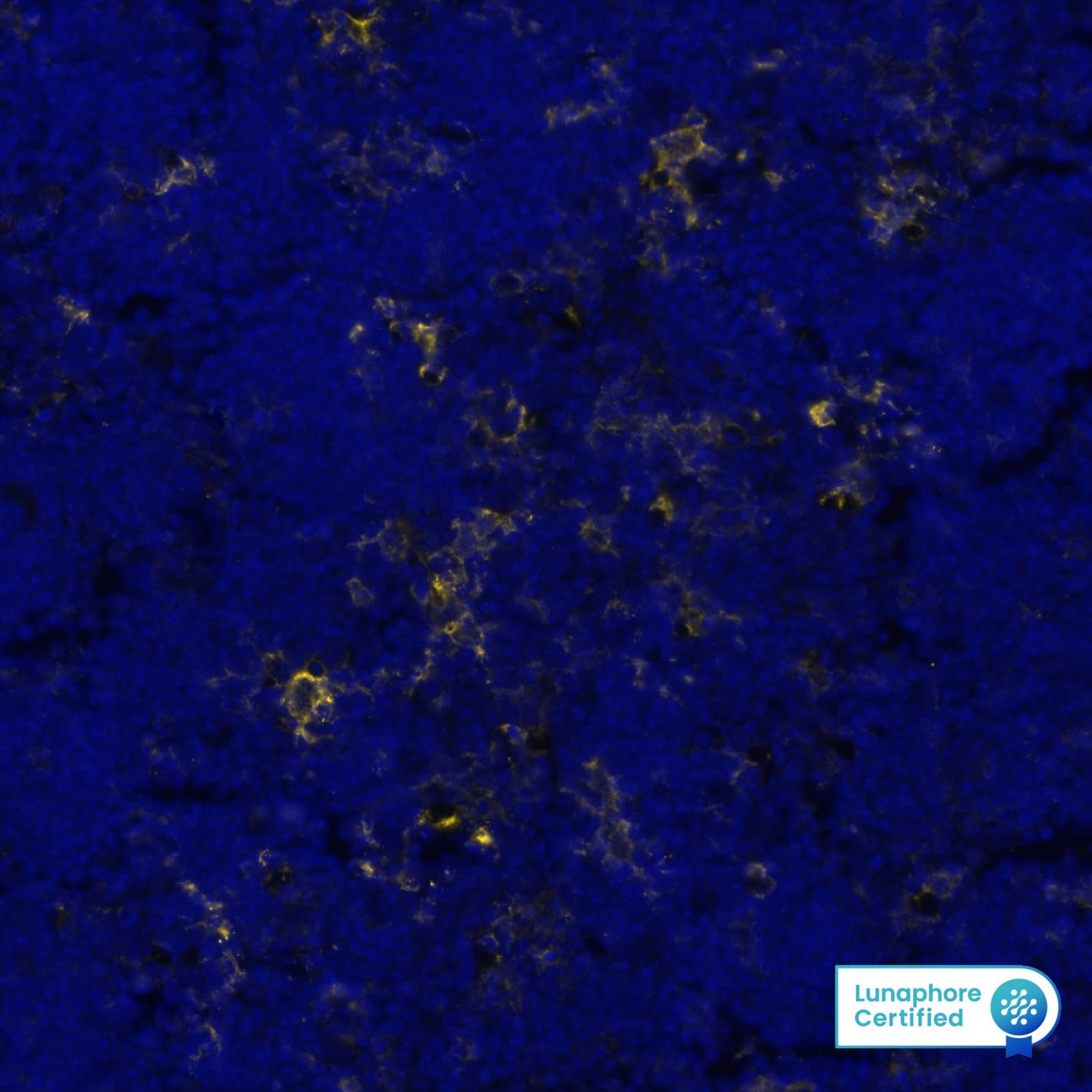 Multiplex Immunofluorescence Fc gamma RIIIB/CD16b Antibody (1107512) [Unconjugated]