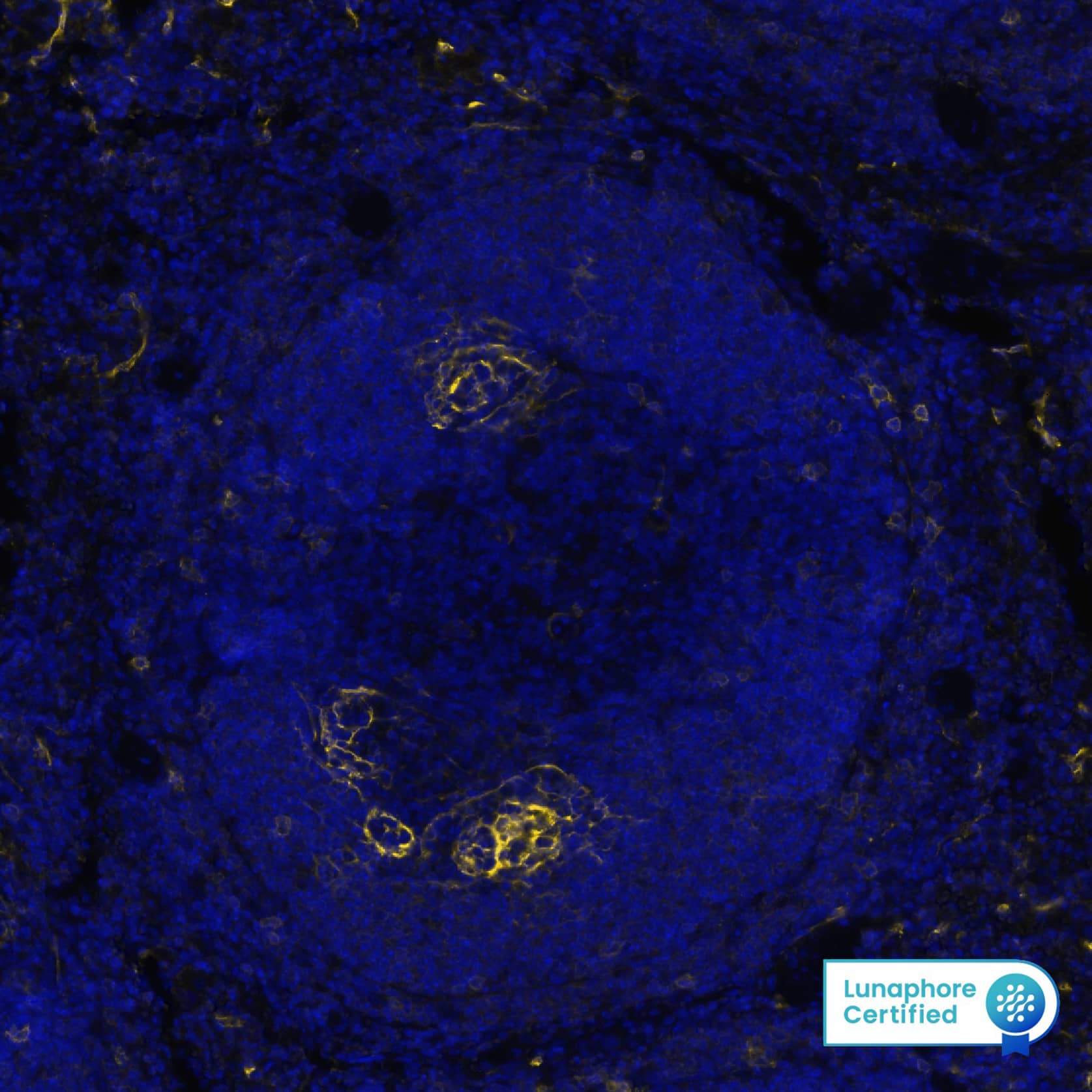 Multiplex Immunofluorescence Fc gamma RIIIB/CD16b Antibody (1107512) [Unconjugated]