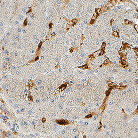 Fc gamma  RIIIA/CD16a was detected in immersion fixed paraffin-embedded sections of human liver using Mouse Anti-Human Fc gamma  RIIIA/CD16a Monoclonal Antibody (Catalog # MAB11728) at 1 µg/ml for 1 hour at room temperature followed by incubation with the Anti-Mouse IgG VisUCyte™ HRP Polymer Antibody (Catalog # VC001) or the HRP-conjugated Anti-Mouse IgG Secondary Antibody (Catalog # HAF007). Before incubation with the primary antibody, tissue was subjected to heat-induced epitope retrieval using VisUCyte Antigen Retrieval Reagent-Basic (Catalog # VCTS021). Tissue was stained using DAB (brown) and counterstained with hematoxylin (blue). Specific staining was localized to the cell surface. View our protocol for IHC Staining with VisUCyte HRP Polymer Detection Reagents.