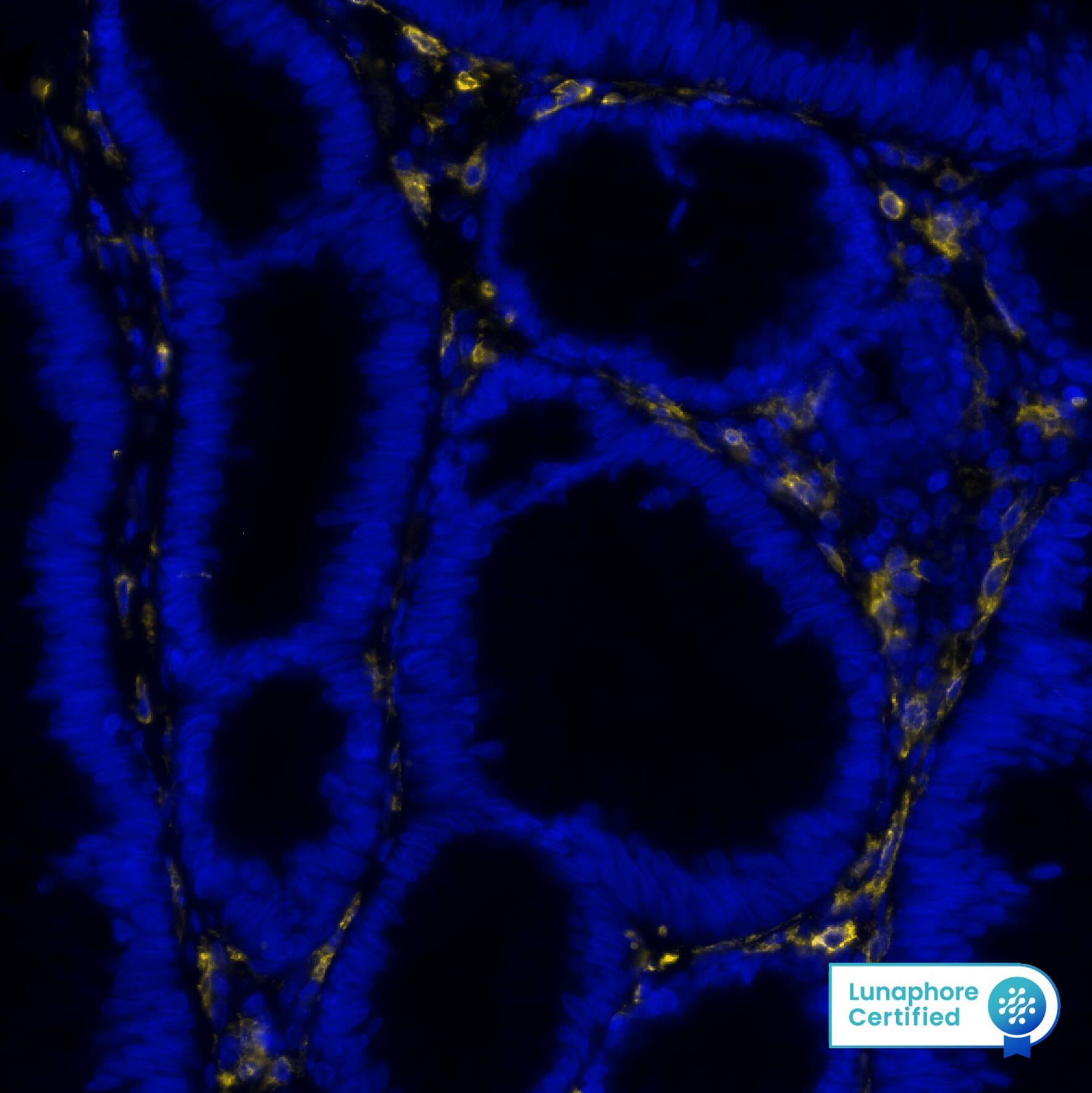 CD16a was detected in immersion fixed paraffin-embedded sections of human Colon using Mouse Anti-Human CD16a, Monoclonal Antibody (Catalog # MAB11728) at 5ug/mL at 37 ° Celsius for 4 minutes. Before incubation with the primary antibody, tissue underwent an all-in-one dewaxing and antigen retrieval preprocessing using PreTreatment Module (PT Module) and Dewax and HIER Buffer H (pH 9; Epredia Catalog # TA-999-DHBH). Tissue was stained using the Alexa Fluor™ Plus 647 Goat anti-Mouse IgG Secondary Antibody at 1:200 at 37° Celsius for 4 minutes. (Yellow; Lunaphore Catalog # DR647MS) and counterstained with DAPI (blue; Lunaphore Catalog # DR100). Specific staining was localized to the membrane. Protocol available in COMET™ Panel Builder.