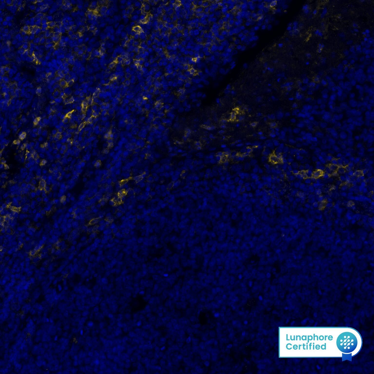 CD16a was detected in immersion fixed paraffin-embedded sections of human Tonsil using Mouse Anti-Human CD16a, Monoclonal Antibody (Catalog # MAB11728) at 5ug/mL at 37 ° Celsius for 4 minutes. Before incubation with the primary antibody, tissue underwent an all-in-one dewaxing and antigen retrieval preprocessing using PreTreatment Module (PT Module) and Dewax and HIER Buffer H (pH 9; Epredia Catalog # TA-999-DHBH). Tissue was stained using the Alexa Fluor™ Plus 647 Goat anti-Mouse IgG Secondary Antibody at 1:200 at 37° Celsius for 4 minutes. (Yellow; Lunaphore Catalog # DR647MS) and counterstained with DAPI (blue; Lunaphore Catalog # DR100). Specific staining was localized to the membrane. Protocol available in COMET™ Panel Builder.