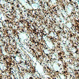 SNAP25 was detected in immersion fixed paraffin-embedded sections of human brain cortex using Mouse Anti-Human SNAP25 Monoclonal Antibody (Catalog # MAB11729) at 5 µg/ml overnight at 4 &deg;C. Before incubation with the primary antibody, tissue was subjected to heat-induced epitope retrieval using VisUCyte Antigen Retrieval Reagent-Basic (Catalog # VCTS021). Tissue was stained using the HRP-conjugated Anti-Mouse IgG Secondary Antibody (Catalog # HAF007) and counterstained with hematoxylin (blue). Specific staining was localized to the vesicles. View our protocol for Chromogenic IHC Staining of Paraffin-embedded Tissue Sections.