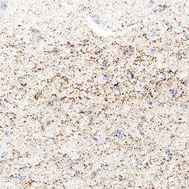 SNAP25 was detected in immersion fixed paraffin-embedded sections of human hypothalamus using Mouse Anti-Human SNAP25 Monoclonal Antibody (Catalog # MAB11729) at 1 µg/ml for 1 hour at room temperature followed by incubation with the Anti-Mouse IgG VisUCyte&trade; HRP Polymer Antibody (Catalog # VC001) or the HRP-conjugated Anti-Mouse IgG Secondary Antibody (Catalog # HAF007). Before incubation with the primary antibody, tissue was subjected to heat-induced epitope retrieval using VisUCyte Antigen Retrieval Reagent-Basic (Catalog # VCTS021). Tissue was stained using DAB (brown) and counterstained with hematoxylin (blue). Specific staining was localized to synapses. View our protocol for IHC Staining with VisUCyte HRP Polymer Detection Reagents.