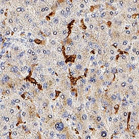 CD163 was detected in immersion fixed paraffin-embedded sections of human liver using Mouse Anti-Human CD163 Monoclonal Antibody (Catalog # MAB11730) at 5 µg/ml for 1 hour at room temperature followed by incubation with the Anti-Mouse IgG VisUCyte™ HRP Polymer Antibody (Catalog # VC001) or the HRP-conjugated Anti-Mouse IgG Secondary Antibody (Catalog # HAF007). Before incubation with the primary antibody, tissue was subjected to heat-induced epitope retrieval using VisUCyte Antigen Retrieval Reagent-Basic (Catalog # VCTS021). Tissue was stained using DAB (brown) and counterstained with hematoxylin (blue). Specific staining was localized to the cell surface of Kupffer cells. View our protocol for IHC Staining with VisUCyte HRP Polymer Detection Reagents.