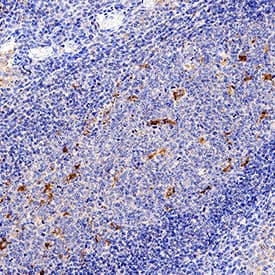 CD163 was detected in immersion fixed paraffin-embedded sections of human tonsil using Mouse Anti-Human CD163 Monoclonal Antibody (Catalog # MAB11730) at 5 µg/ml for 1 hour at room temperature followed by incubation with the Anti-Mouse IgG VisUCyte™ HRP Polymer Antibody (Catalog # VC001) or the HRP-conjugated Anti-Mouse IgG Secondary Antibody (Catalog # HAF007). Before incubation with the primary antibody, tissue was subjected to heat-induced epitope retrieval using VisUCyte Antigen Retrieval Reagent-Basic (Catalog # VCTS021). Tissue was stained using DAB (brown) and counterstained with hematoxylin (blue). Specific staining was localized to the cell surface. View our protocol for IHC Staining with VisUCyte HRP Polymer Detection Reagents.