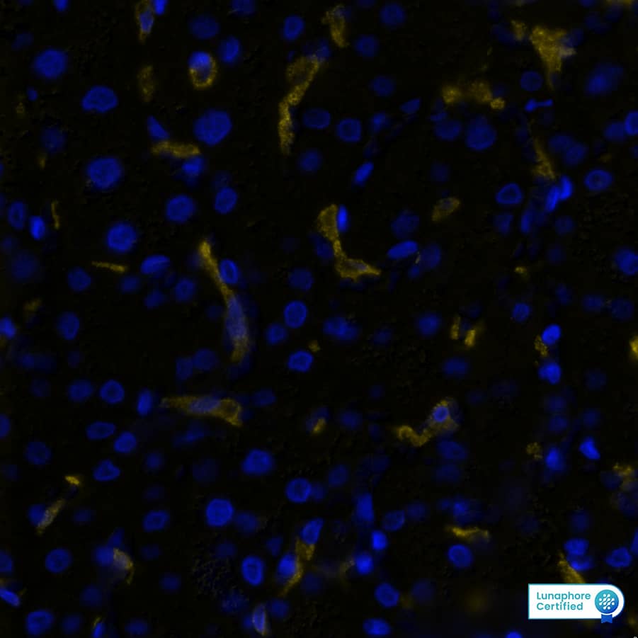 CD163 was detected in immersion fixed paraffin-embedded sections of human Liver using Mouse Anti-Human CD163, Monoclonal Antibody (Catalog #MAB11730) at 5ug/mL at 37° Celsius for 4 minutes. Before incubation with the primary antibody, tissue underwent an all-in-one dewaxing and antigen retrieval preprocessing using PreTreatment Module (PT Module) and Dewax and HIER Buffer H (pH 9; Epredia Catalog # TA-999-DHBH). Tissue was stained using the Alexa Fluor™ 647 Goat anti-Mouse IgG Secondary Antibody at 1:200 at 37 ° Celsius for 2 minutes. (Yellow; Lunaphore Catalog # DR647MS) and counterstained with DAPI (blue; Lunaphore Catalog # DR100). Specific staining was localized to the membrane. Protocol available in COMET™ Panel Builder.​​